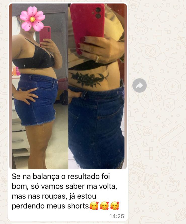 Antes e depois evolução da paciente